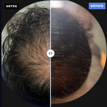 Paciente M., 6 meses de protocolo
