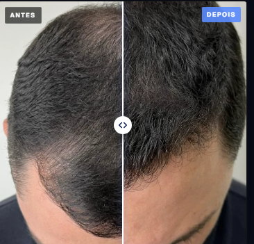 Paciente C., 5 meses de acompanhamento